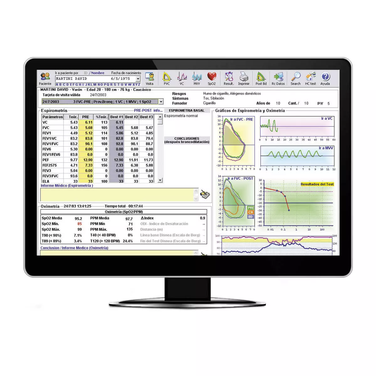  Minispir PC-Spirometer