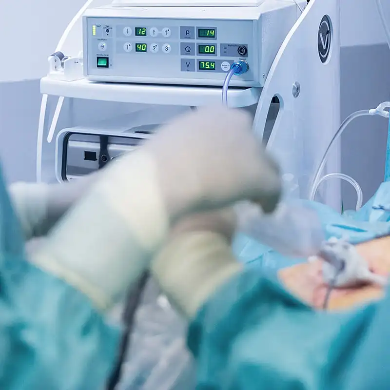 Kategorie 800x800 Hf Chirurgie