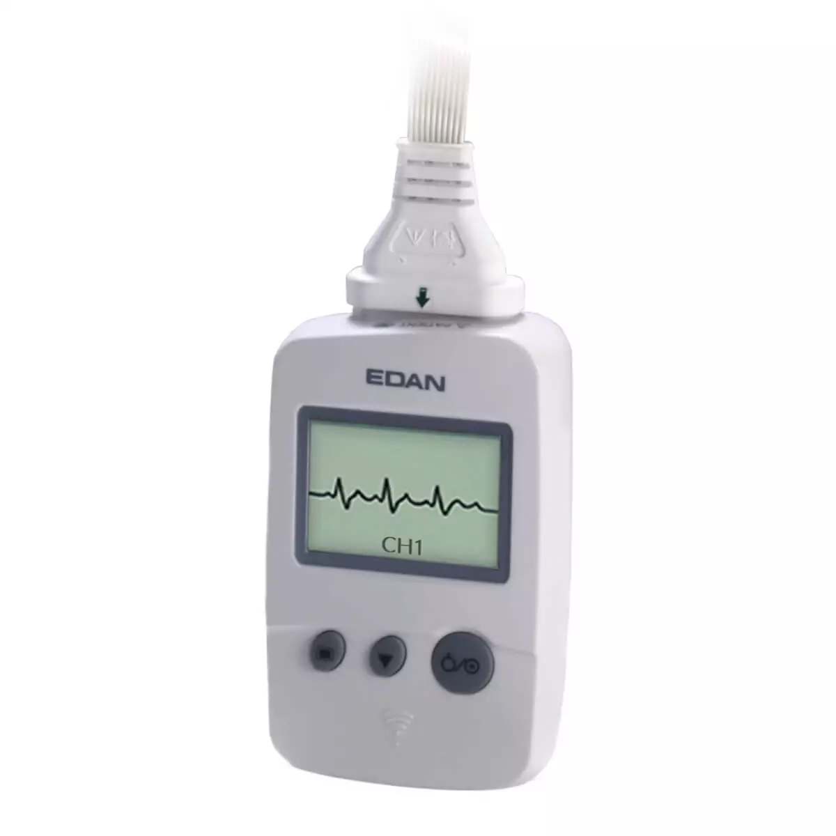  Logiciel de gestion de données ECG SE-1515