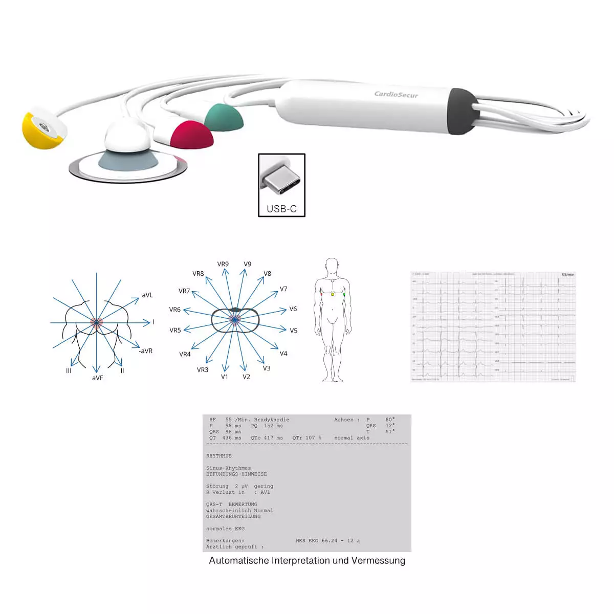 CardioSecur Pro EKG CardioSecur Pro EKG
