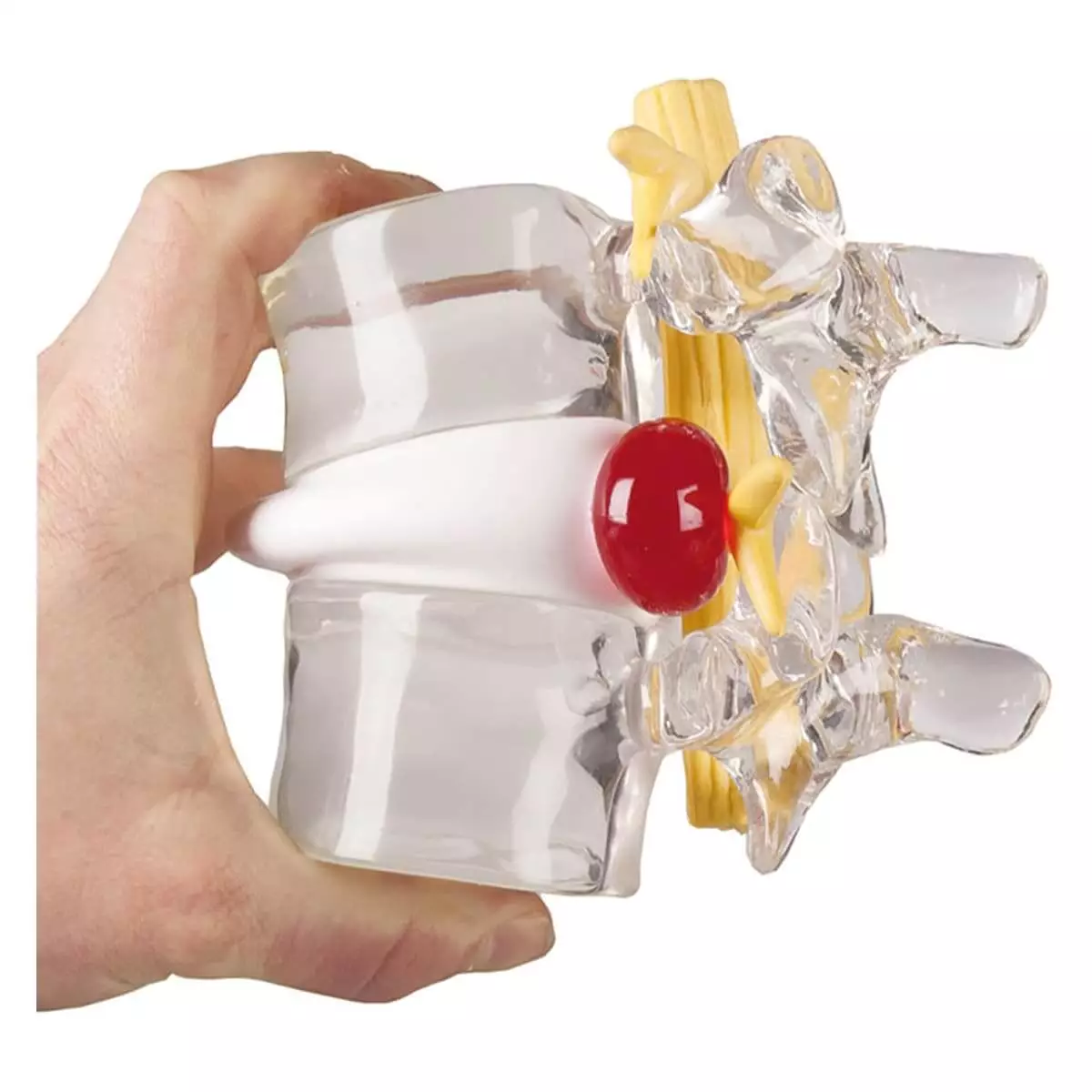  Simulateur de hernie discale