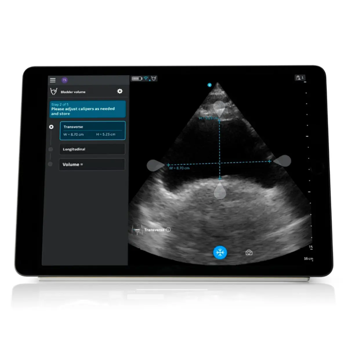  Mise à niveau Auto Bladder Volume pour Vscan Air CL