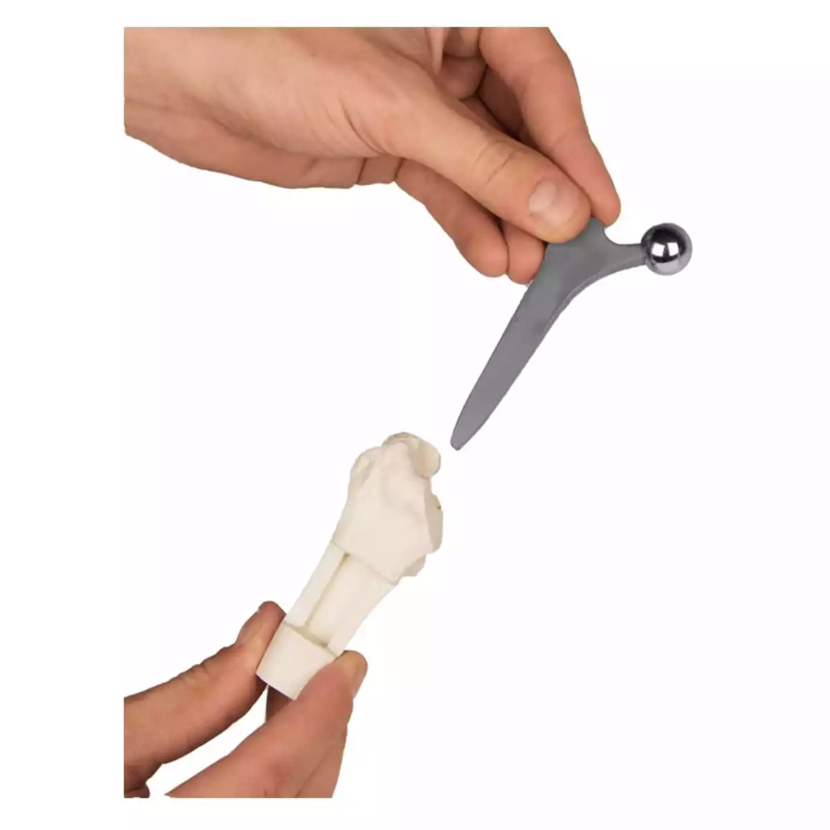  Modèle d'implant de hanche