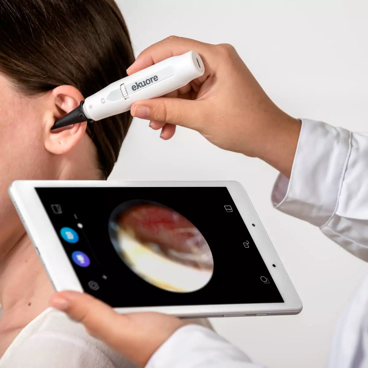  Otoscope numérique eKuore Pro