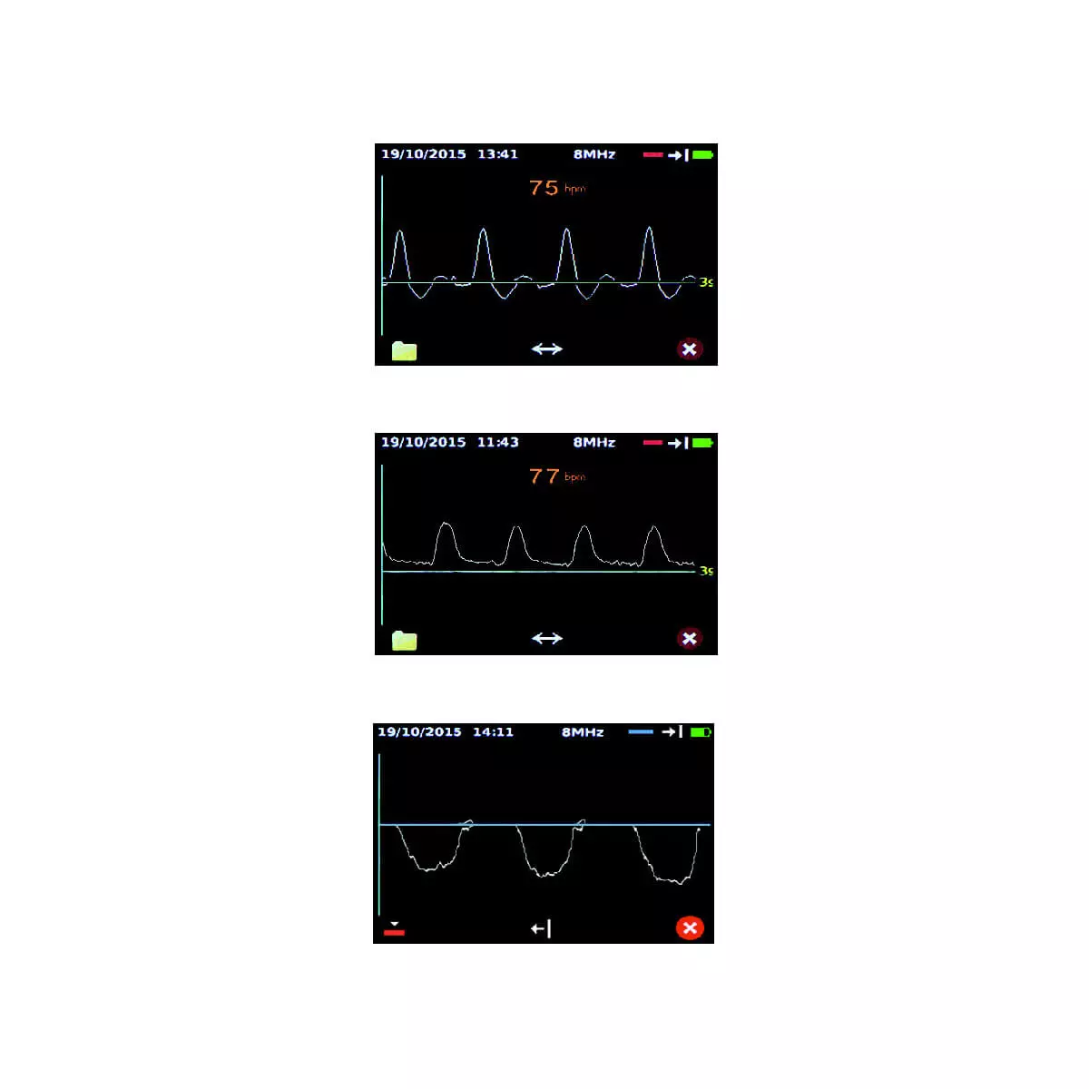  Doppler vasculaire Dopplex DMX