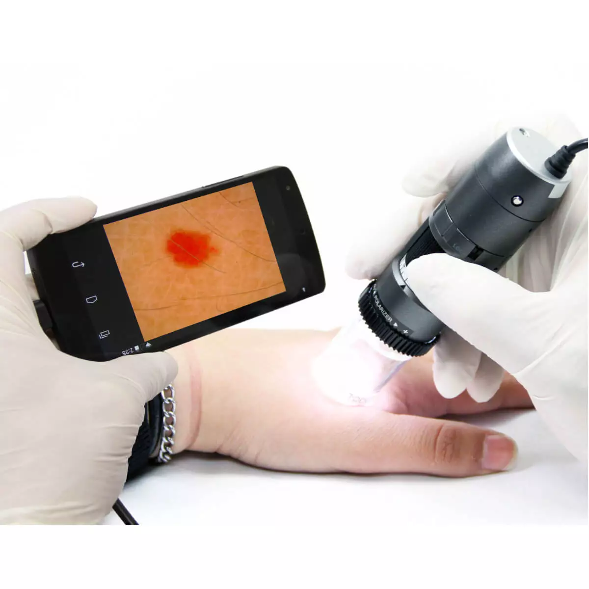  DermaScope Polarizer HR 200x Videodermatoskop