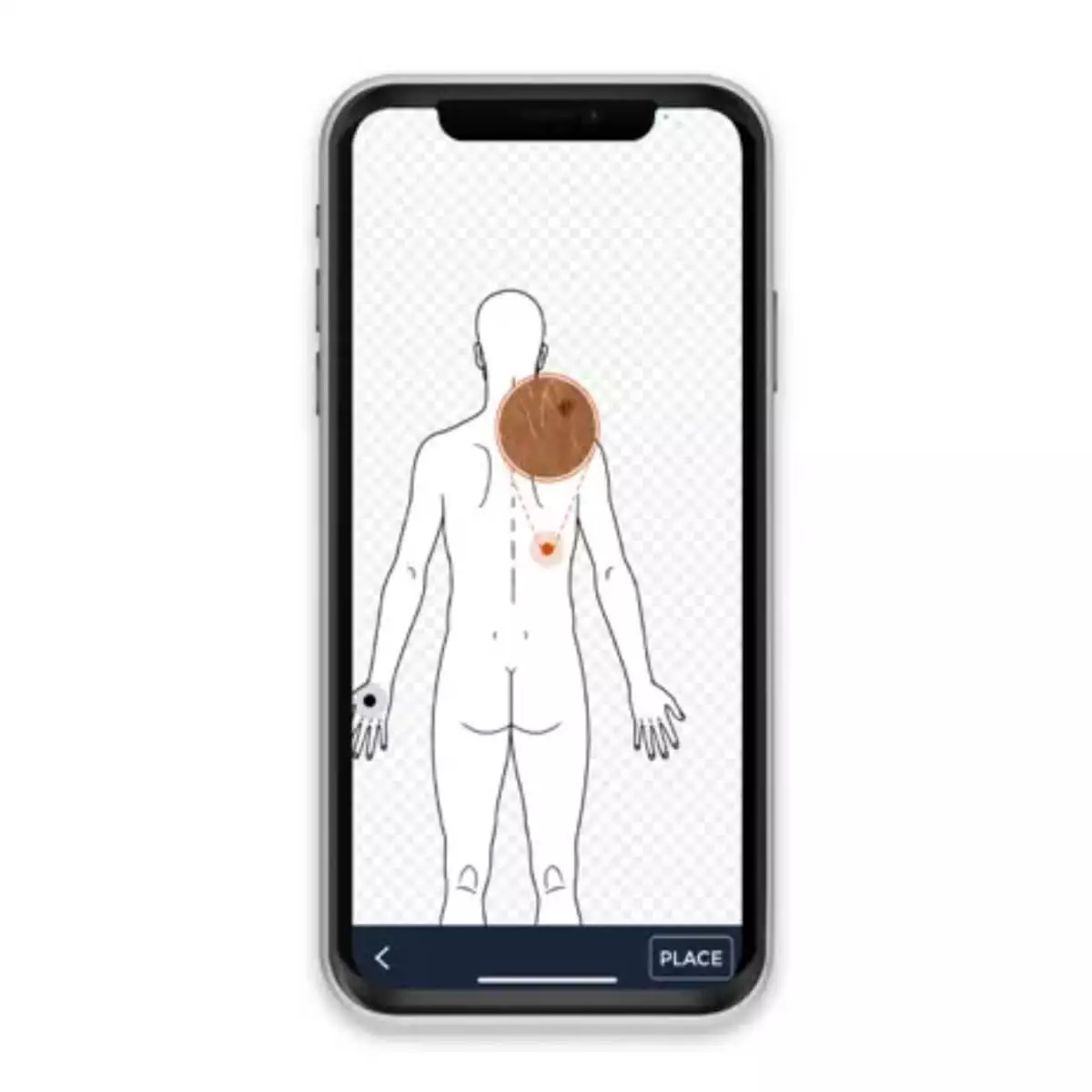  HEINE iC1 Dermatoskop