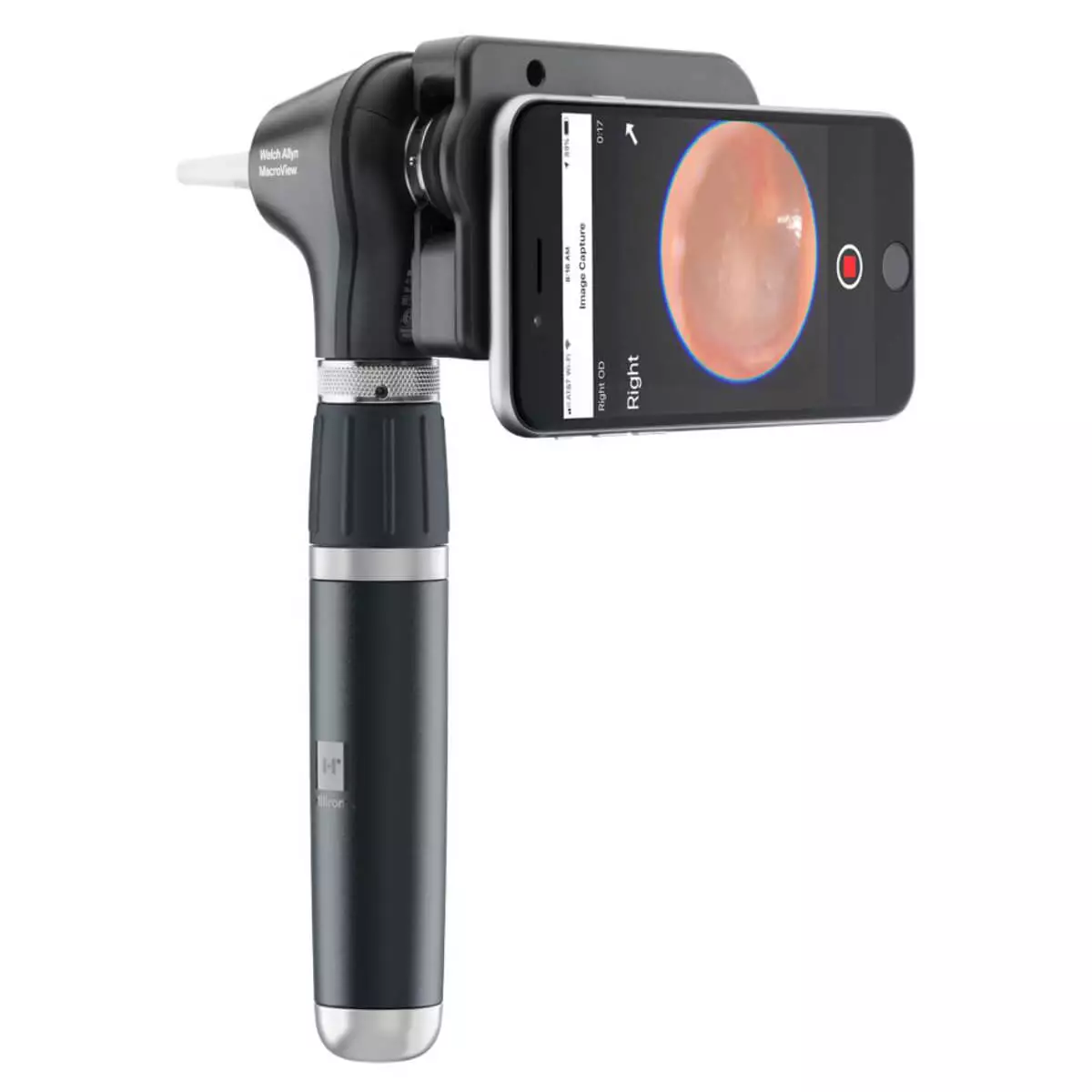  Set de diagnostic avec otoscope MacroView Plus & kit iExaminer