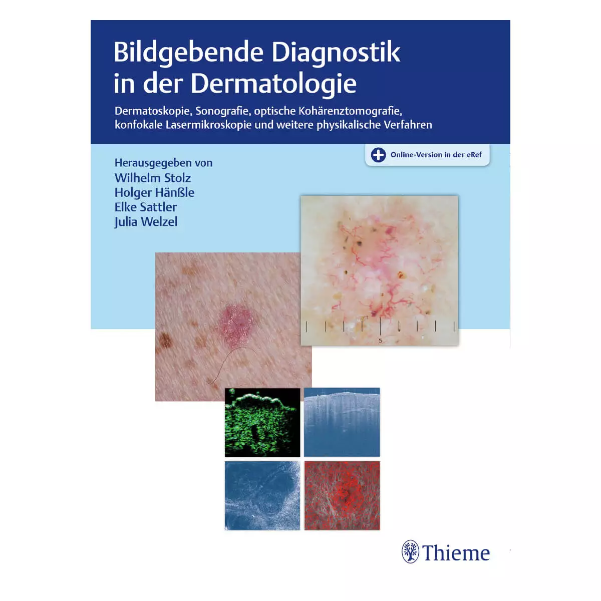  Imagerie diagnostique en dermatologie