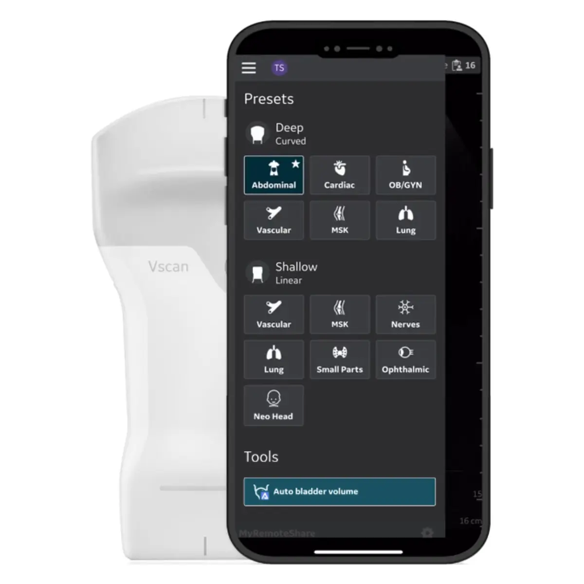 Mise à niveau Auto Bladder Volume pour Vscan Air CL Mise à niveau Auto Bladder Volume pour Vscan Air CL