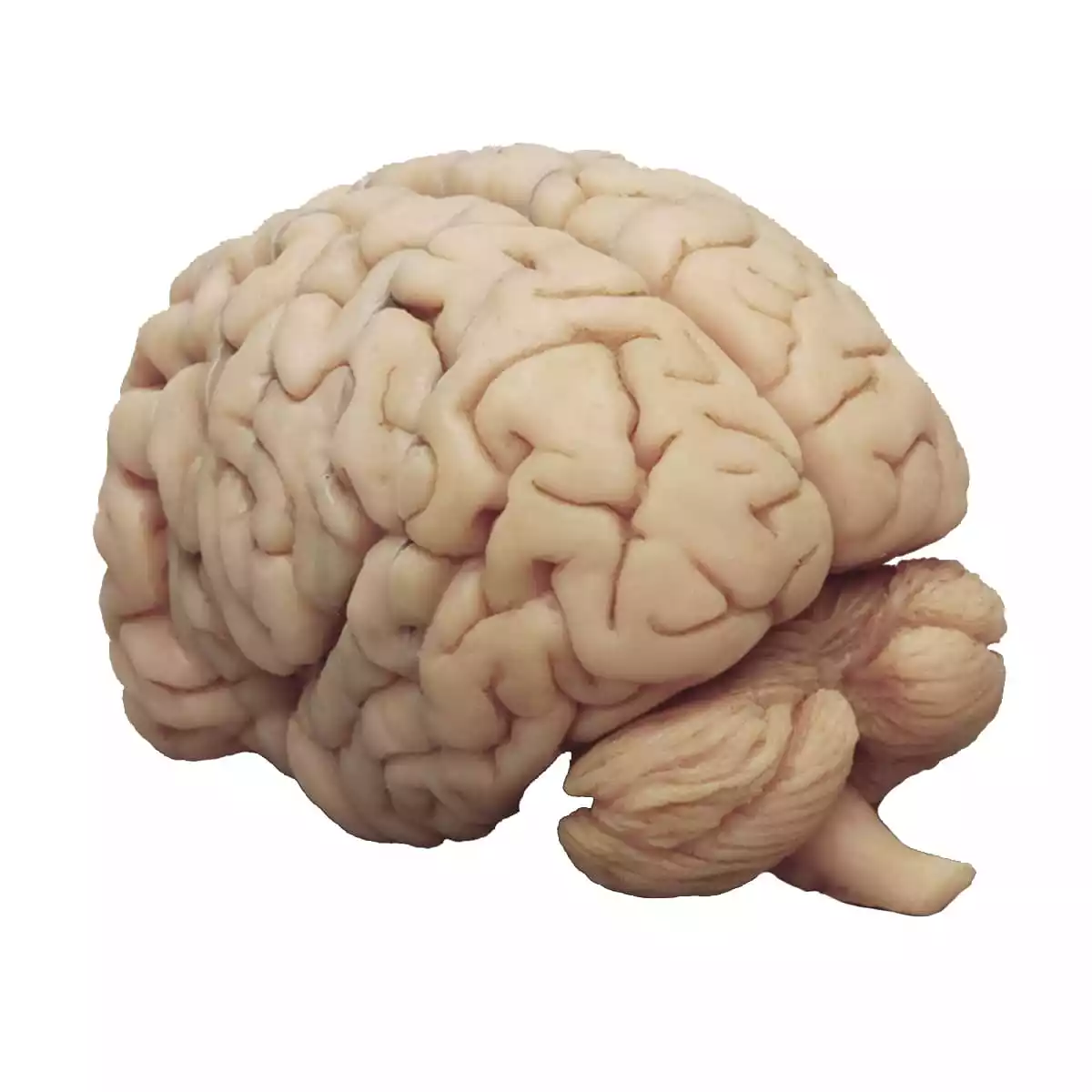  Cerveau humain en coupes frontales