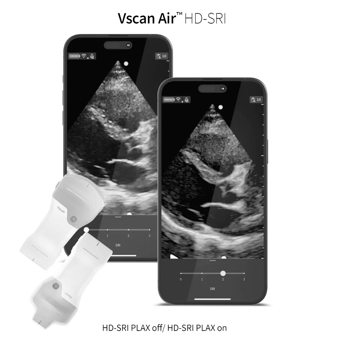 Mise à niveau HD-SRI pour Vscan Air Mise à niveau HD-SRI pour Vscan Air