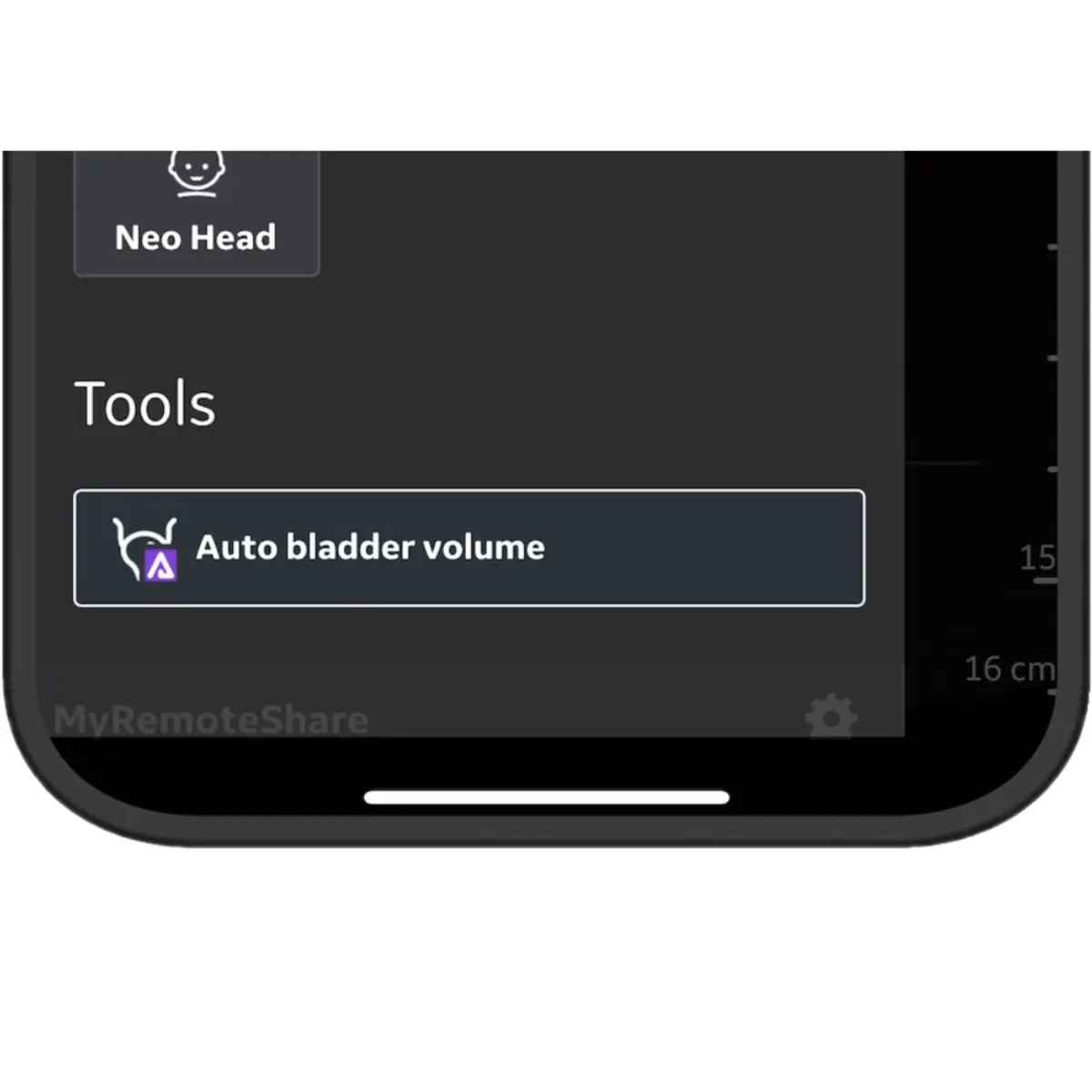  Mise à niveau Auto Bladder Volume pour Vscan Air CL