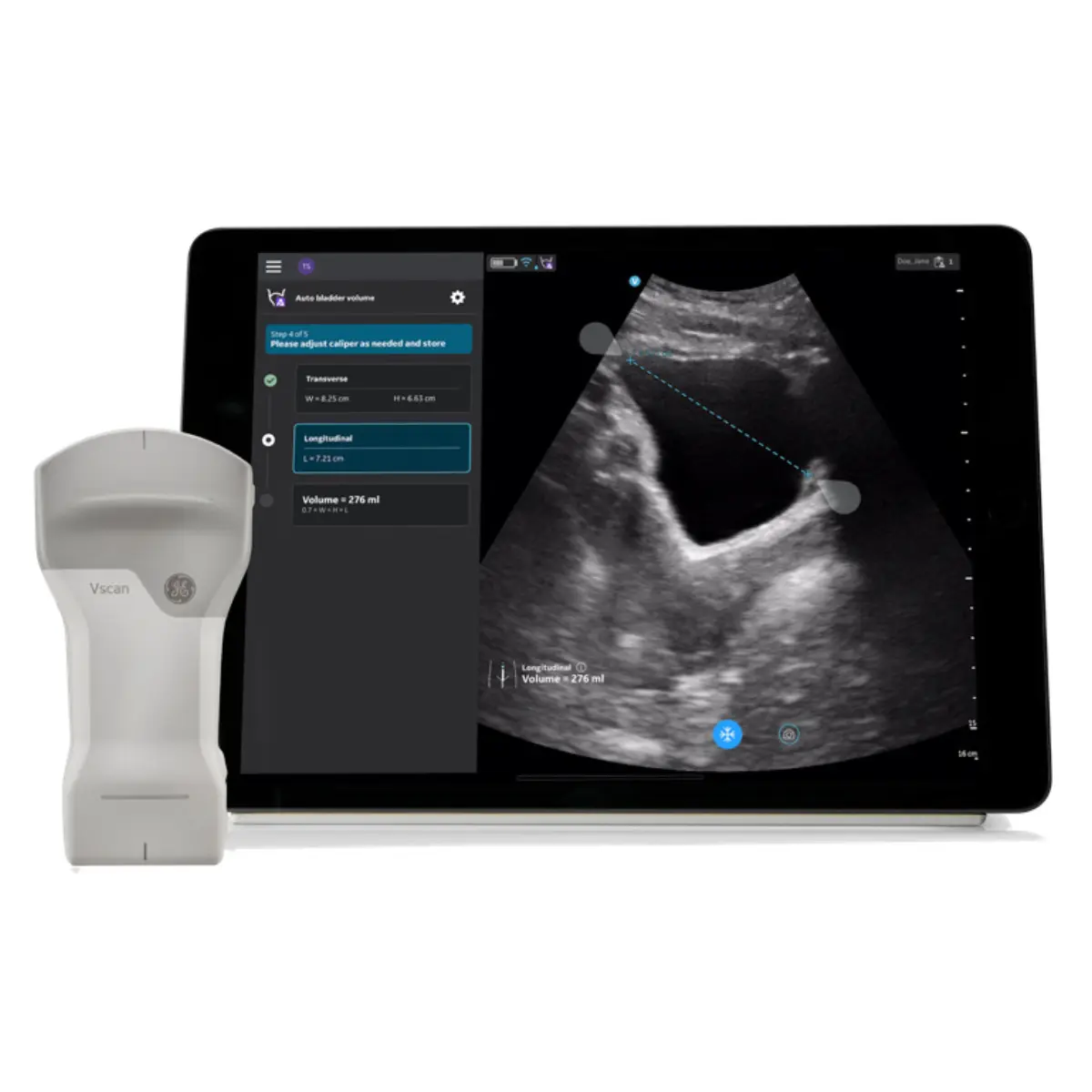 Mise à niveau Auto Bladder Volume pour Vscan Air CL