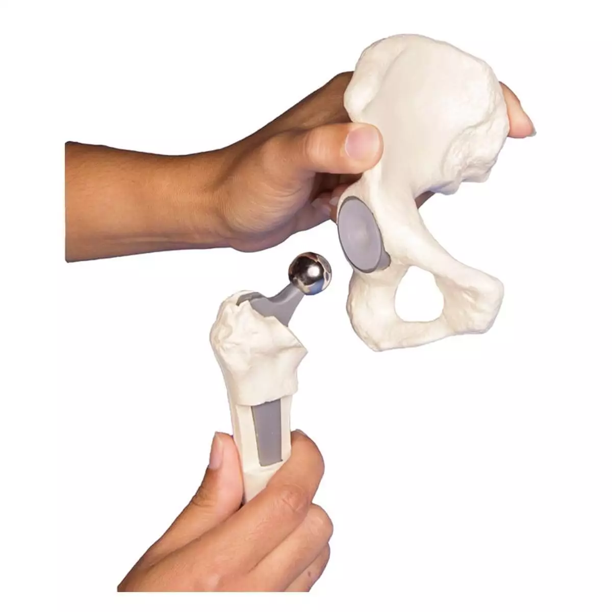  Modèle d'implant de hanche