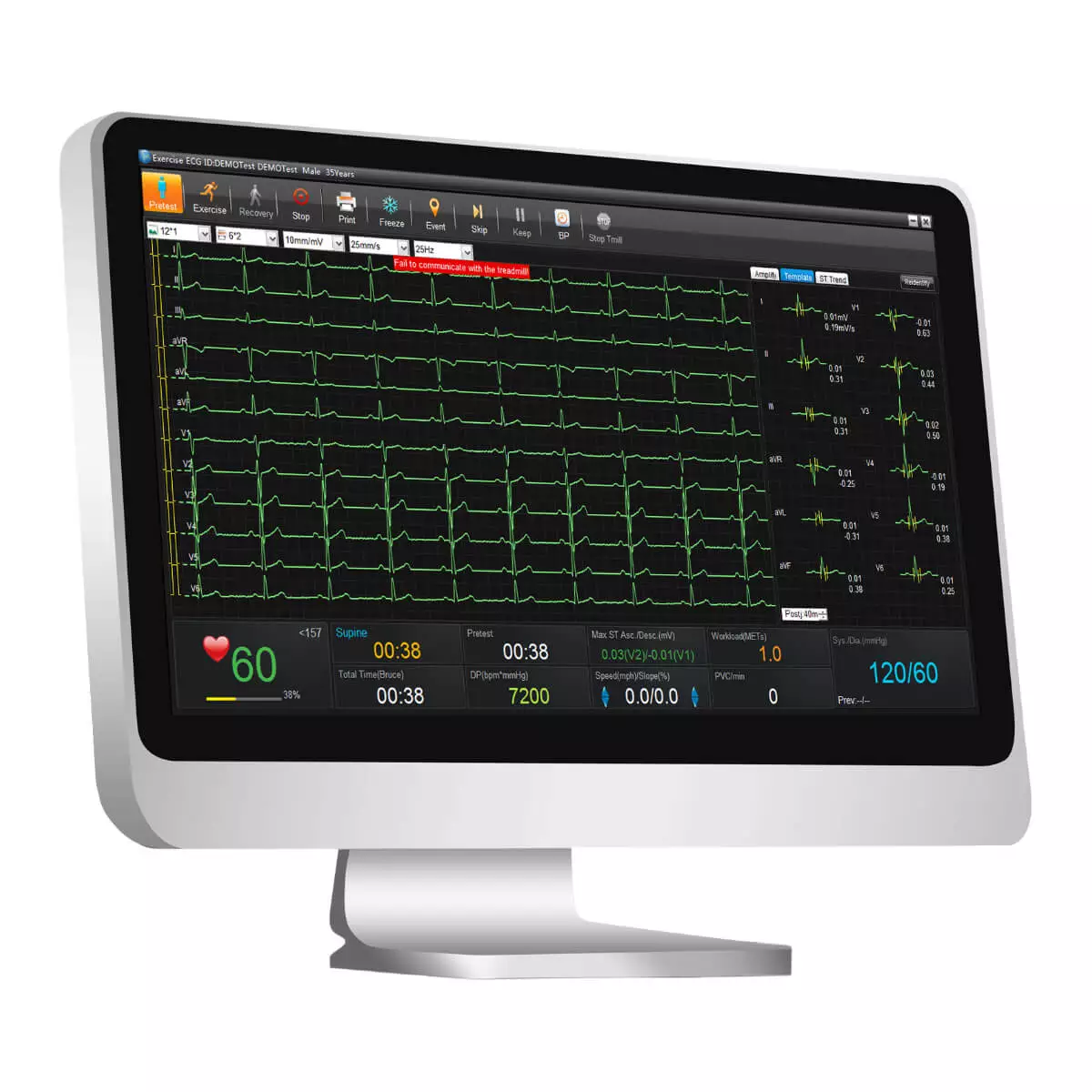  Logiciel de gestion de données ECG SE-1515