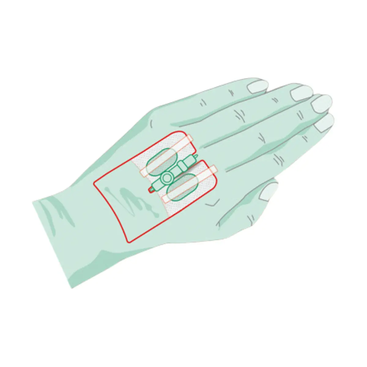  Pansement de fixation pour canule RUDAVEN-universal