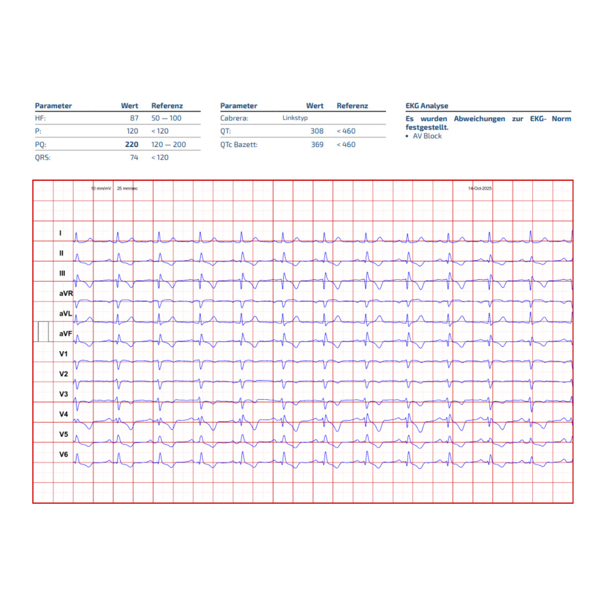 Cardisio 3D-Herz-Screening  Cardisio 3D-Herz-Screening