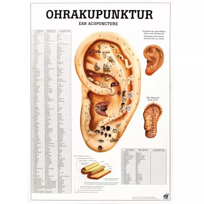  Planche pédagogique - acupuncture auriculaire