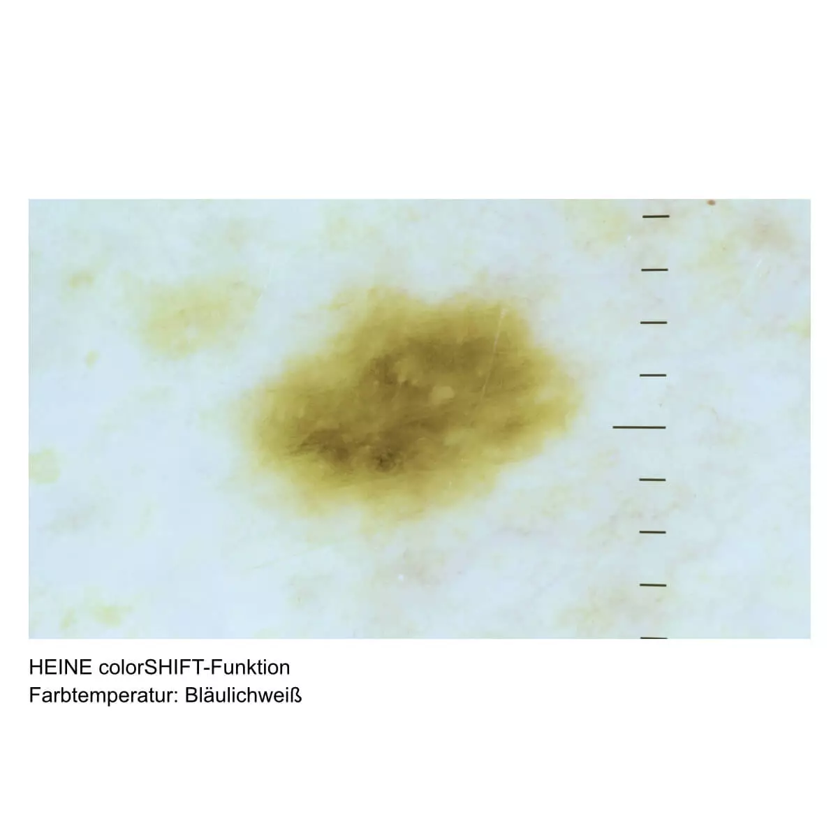  HEINE DELTA 30 PRO Dermatoskop