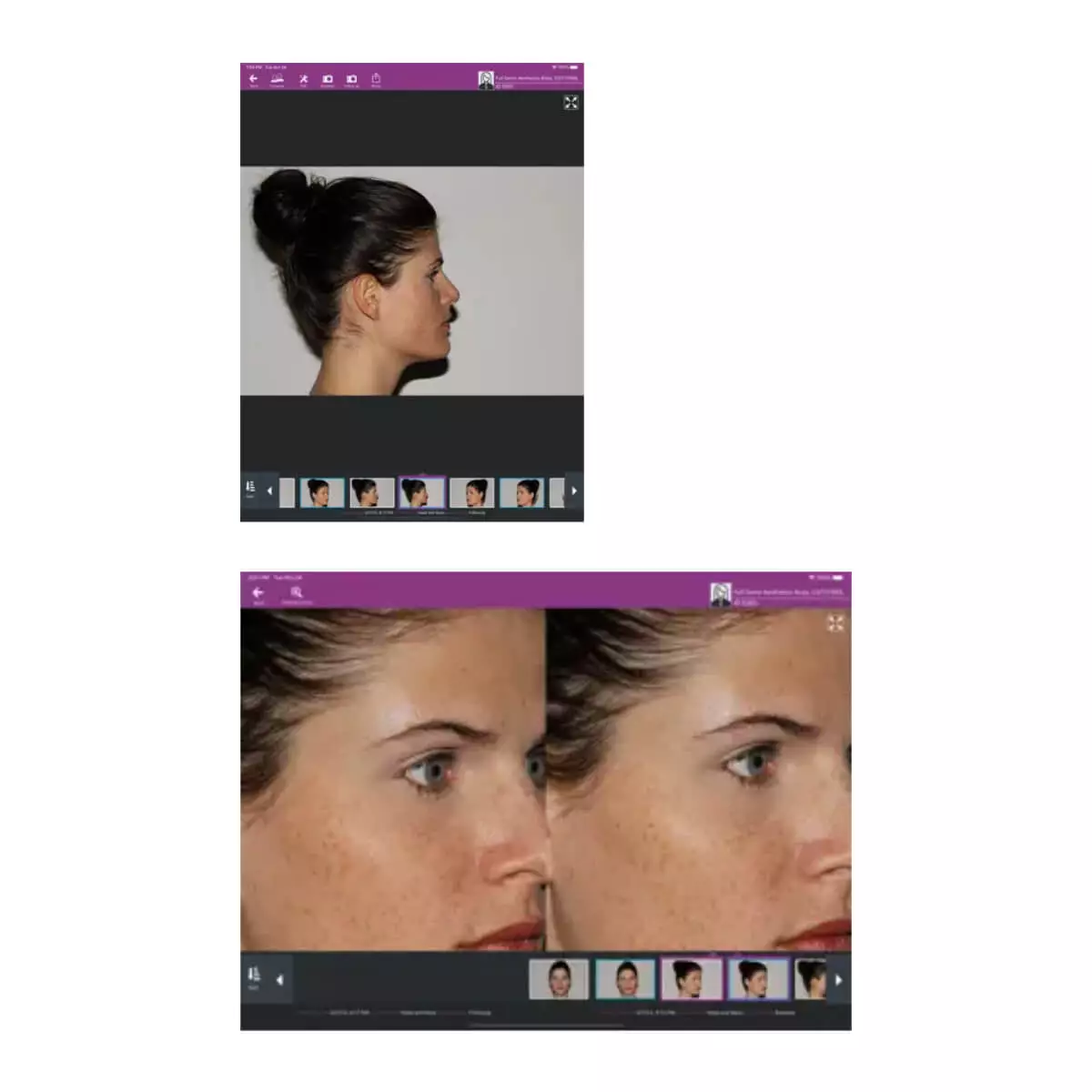  Système d'imagerie pour iOS meesma et service cloud FotoFinder Hub