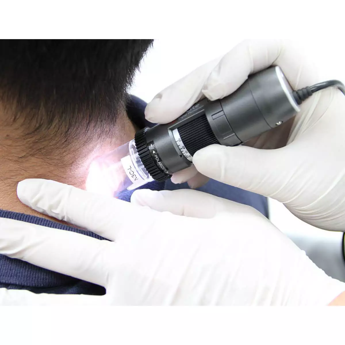  DermaScope Polarizer HR 200x Videodermatoskop
