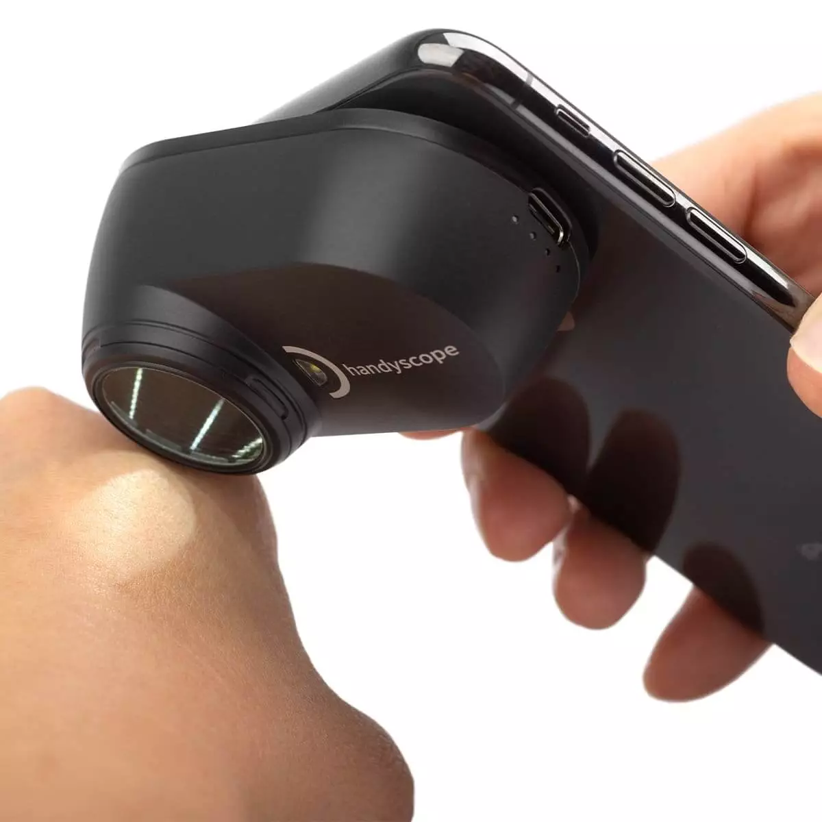  DermLite Handyscope