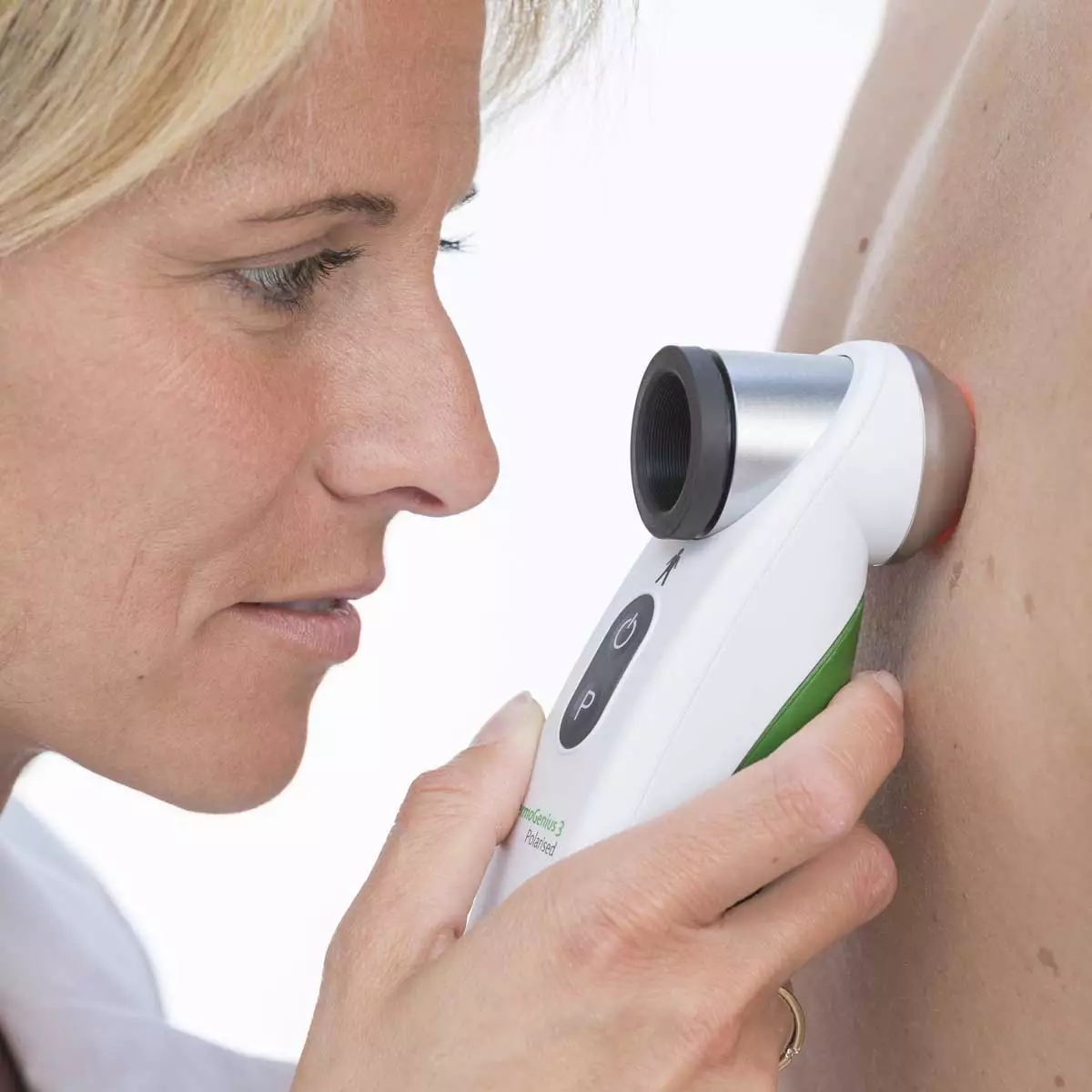  DermoGenius 3 polarised Dermatoskop