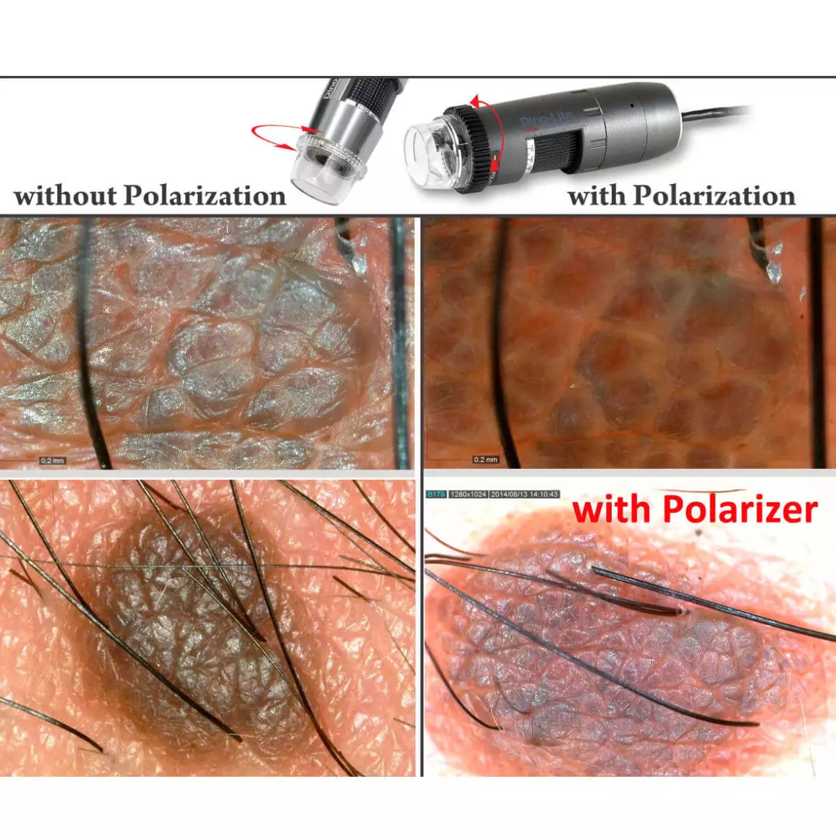  DermaScope Polarizer HR 200x Videodermatoskop