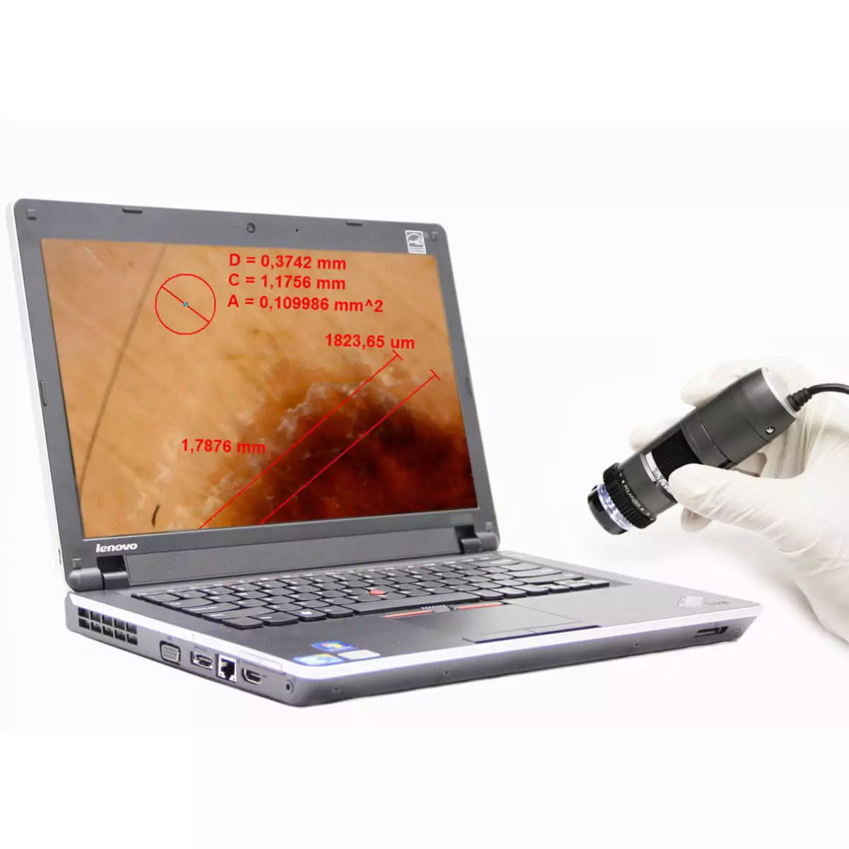  DermaScope Polarizer HR 200x Videodermatoskop