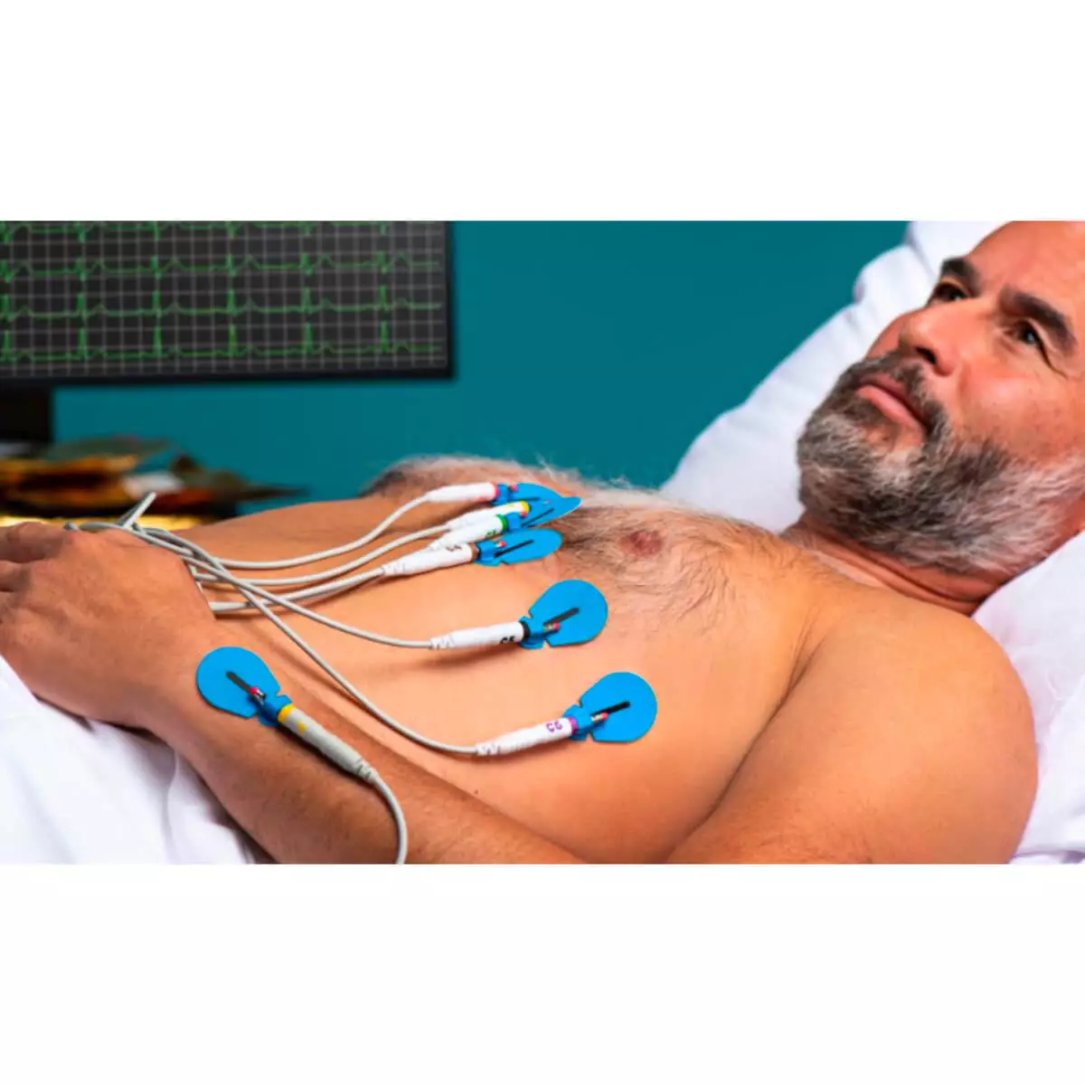 Électrodes ECG à usage unique BlueSensor SU-00-A/60 Électrodes ECG à usage unique BlueSensor SU-00-A/60