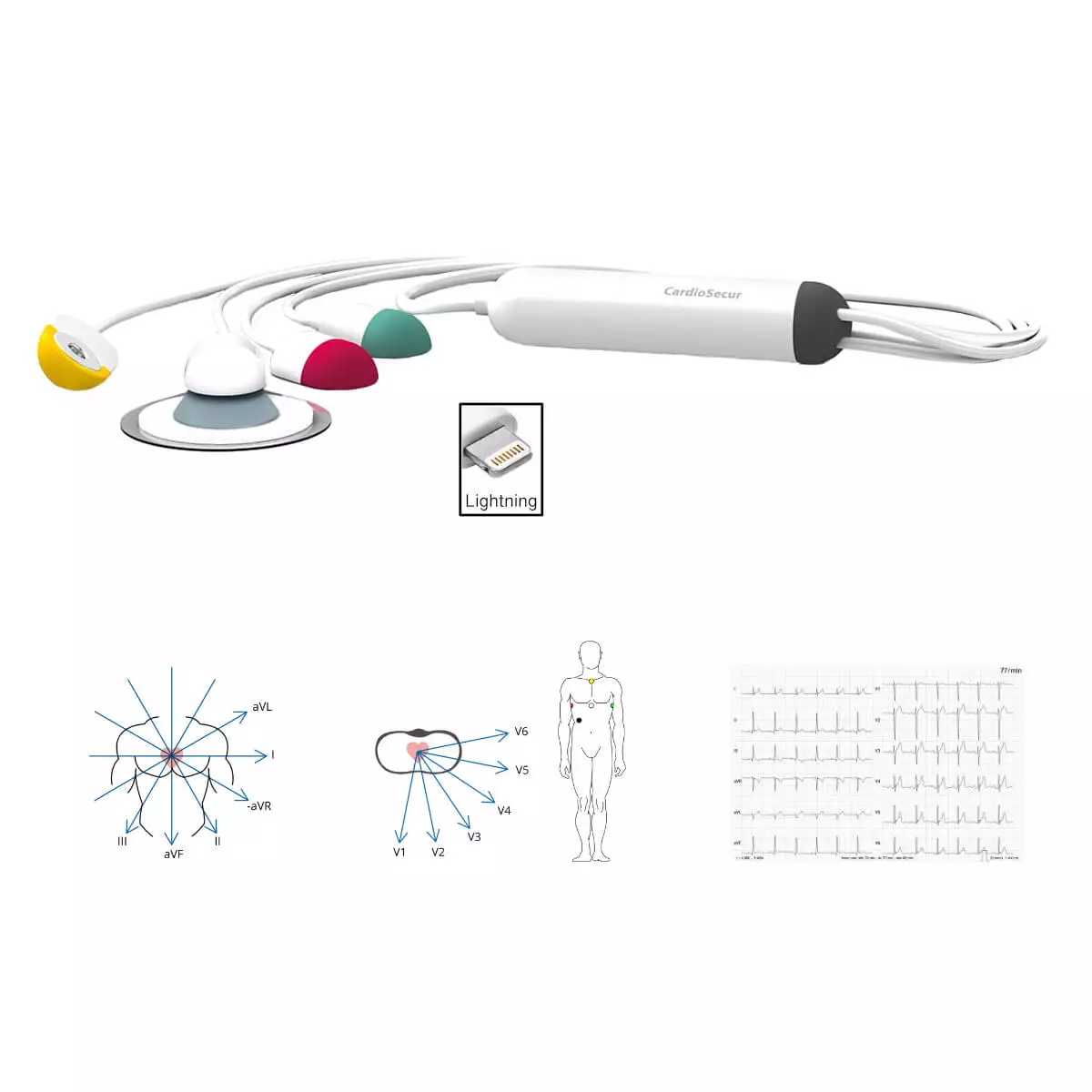  Système ECG CardioSecur Pro
