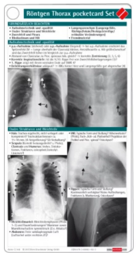  Jeu de cartes de poche X-ray Thorax