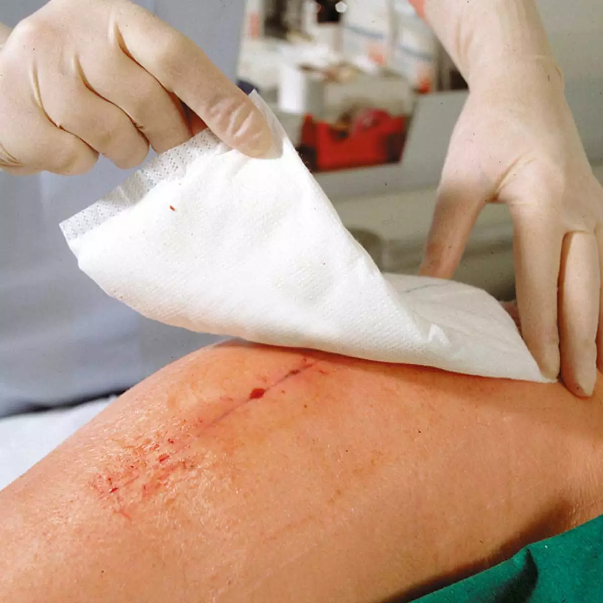  Compresses absorbantes non stériles Zetuvit