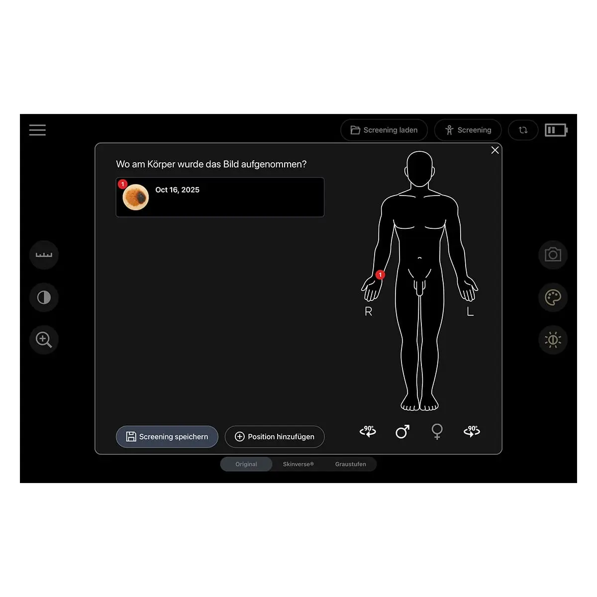  Dermatoscope numérique «Scaut®»