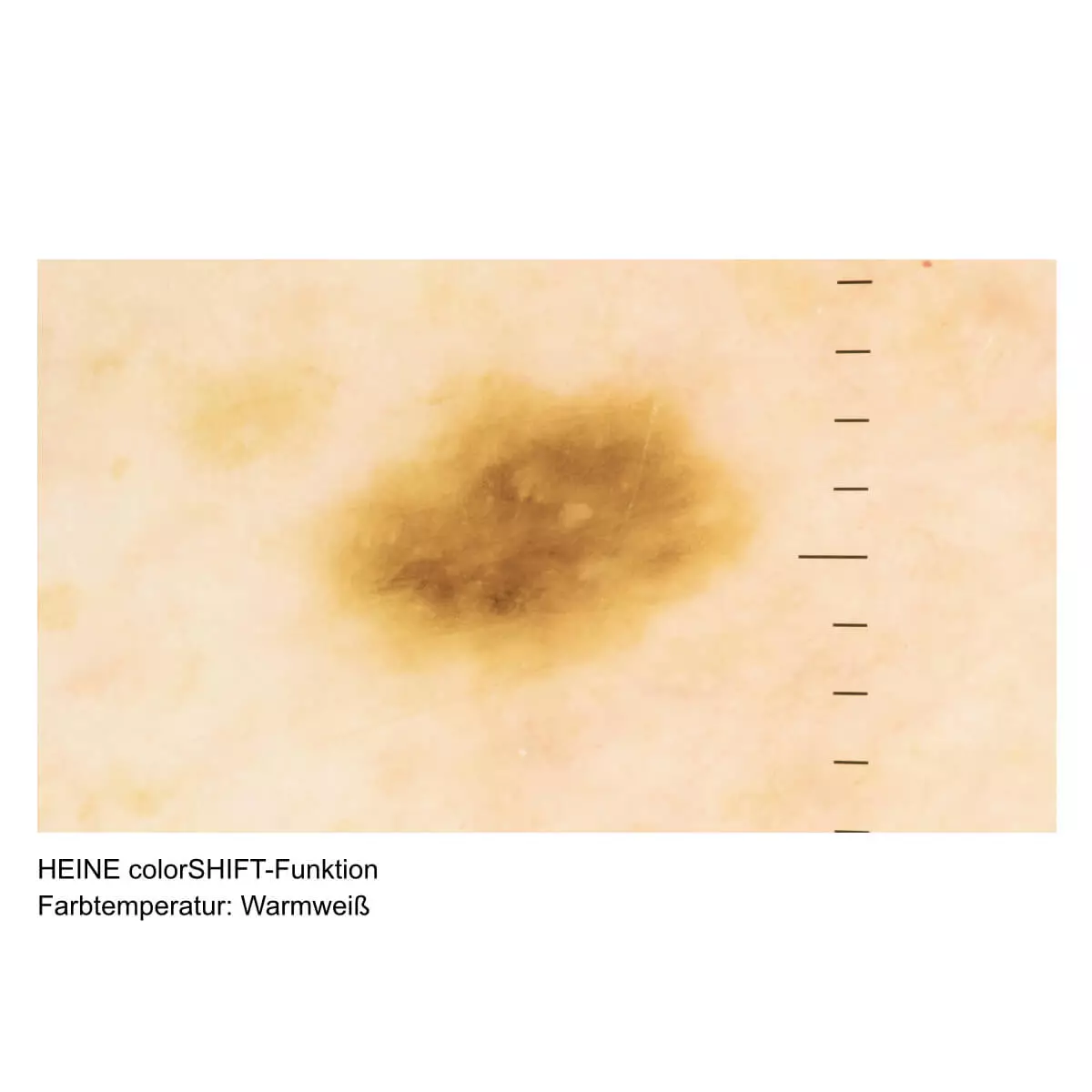  HEINE DELTA 30 PRO Dermatoskop