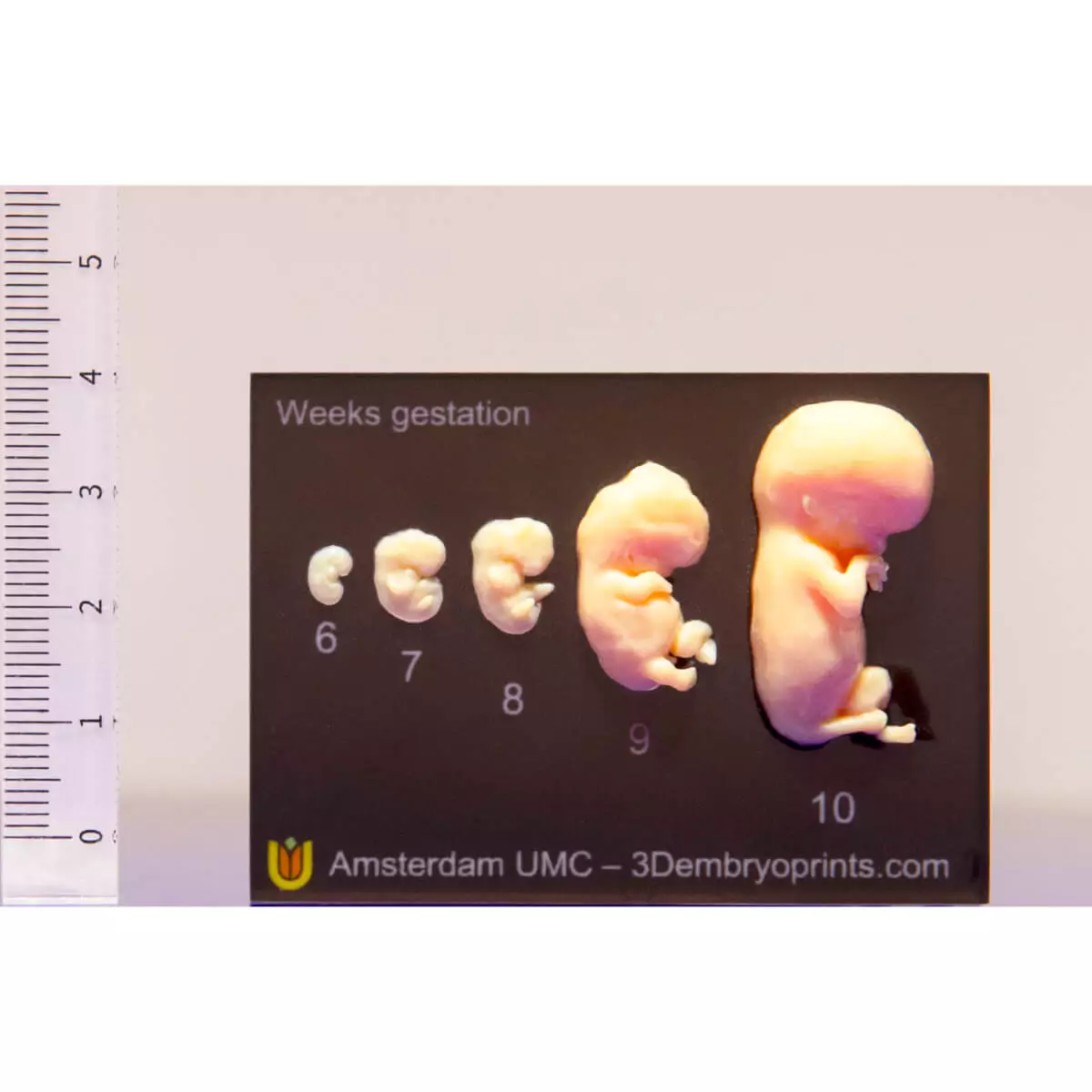  Modèle d’embryons de la 6e à la 10e semaine de grossesse