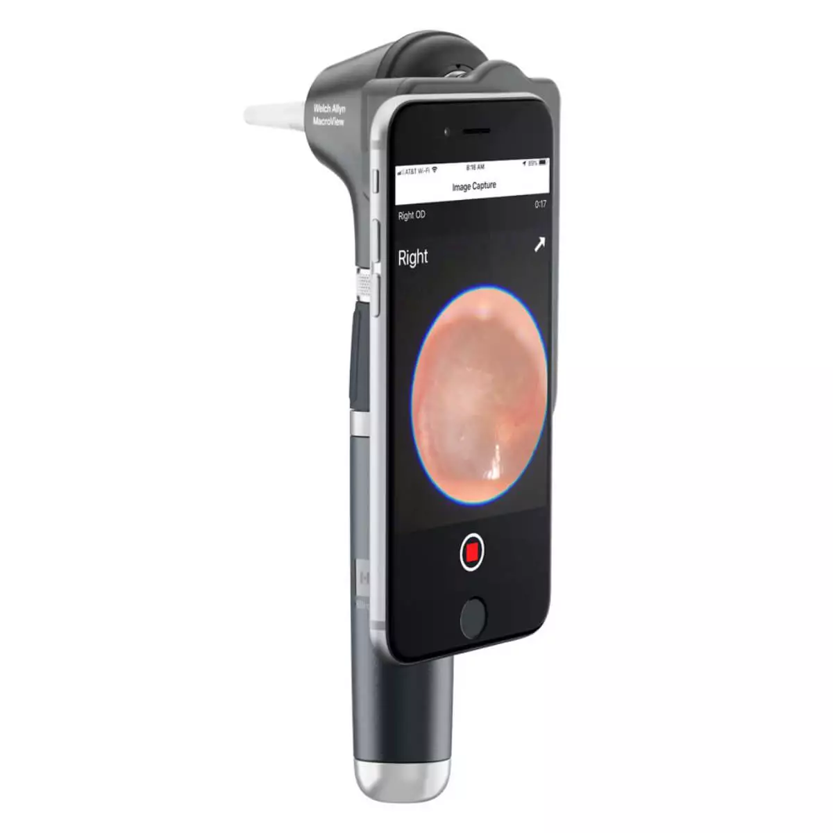 Set de diagnostic avec otoscope MacroView Plus & kit iExaminer