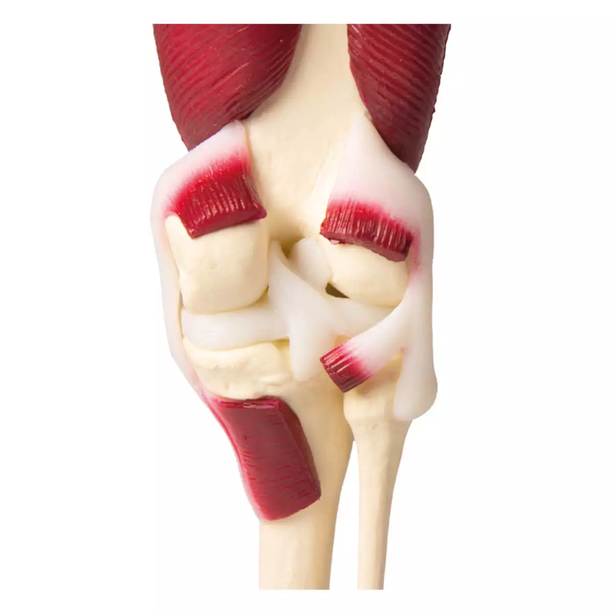  Modèle musculaire de l’articulation du genou