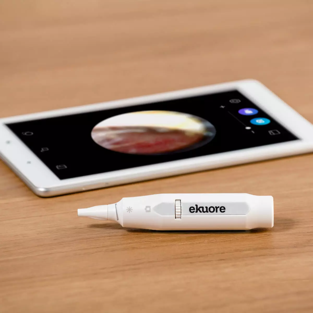  Otoscope numérique eKuore Pro