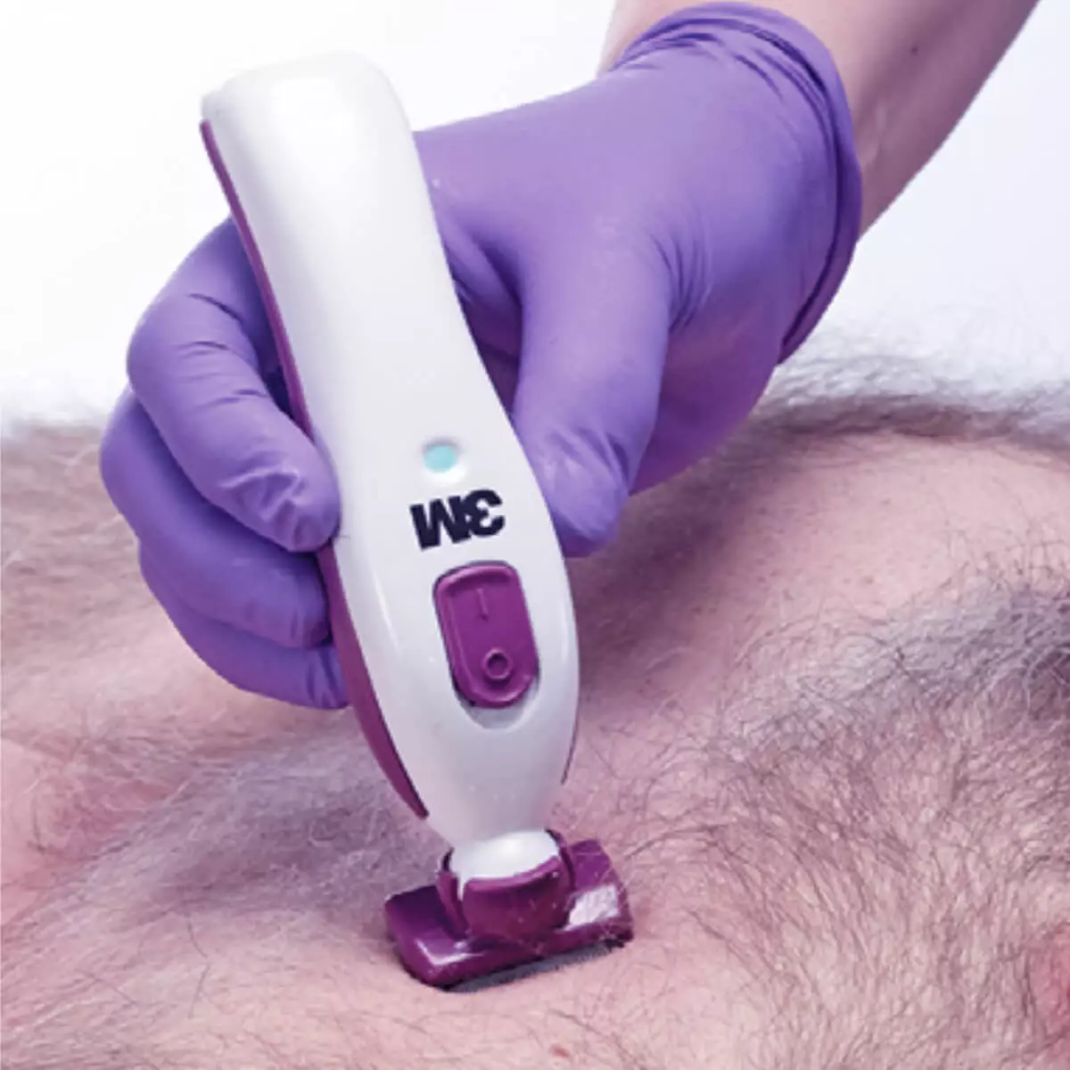  Kit de base Clipper 9661L