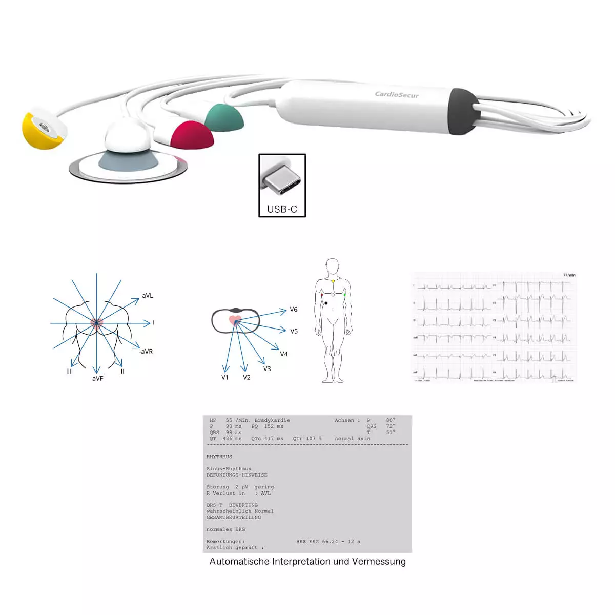 Système ECG CardioSecur Pro Système ECG CardioSecur Pro