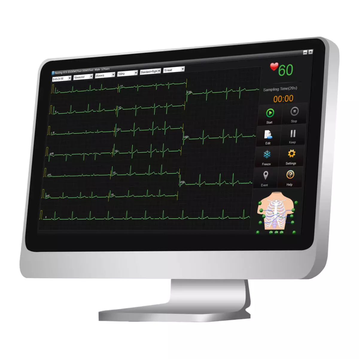  Logiciel de gestion de données ECG SE-1515