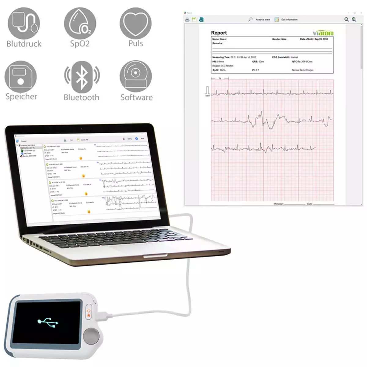  Moniteur d'électrocardiogramme Checkme Lite de Viatom