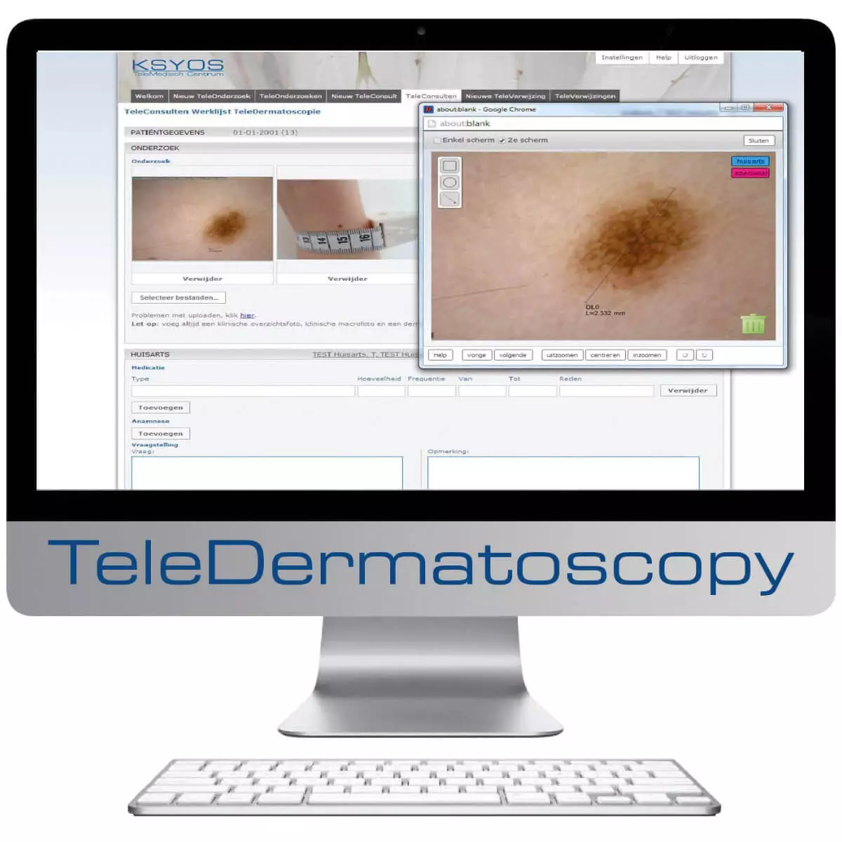  DermaScope Polarizer HR 200x Videodermatoskop