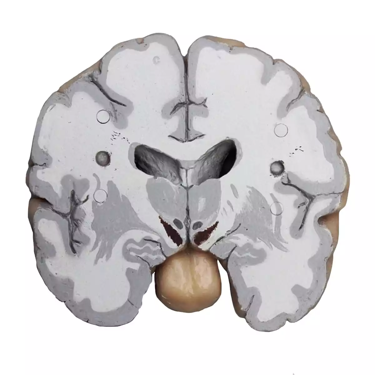  Cerveau humain en coupes frontales