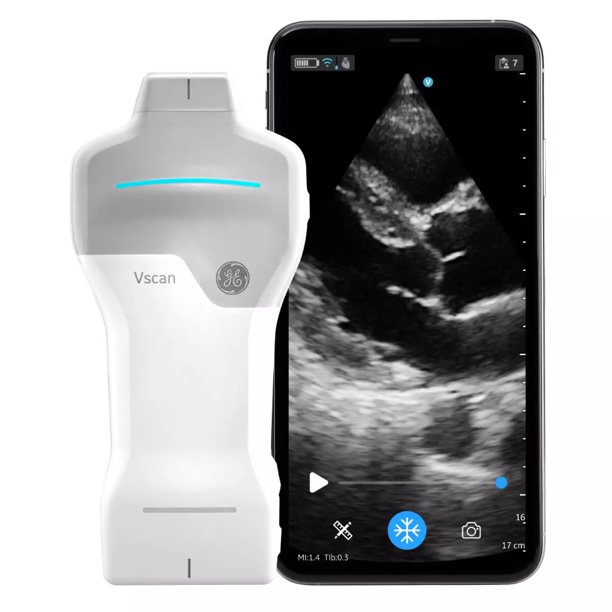 Système d’échographie Vscan Air SL Système d’échographie Vscan Air SL