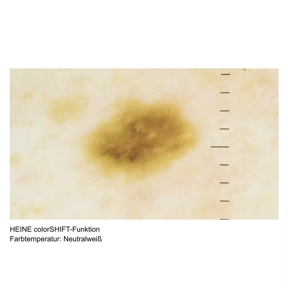  HEINE DELTA 30 PRO Dermatoskop