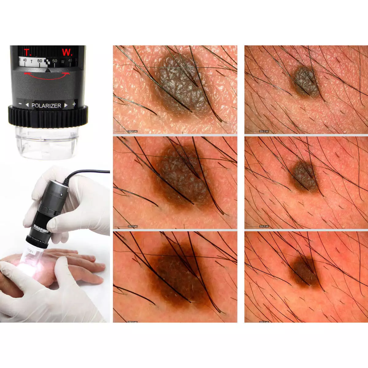  DermaScope Polarizer HR 200x Videodermatoskop