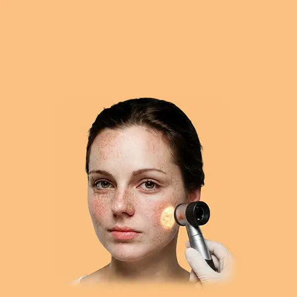 600x600 Feature Dermatoskop
